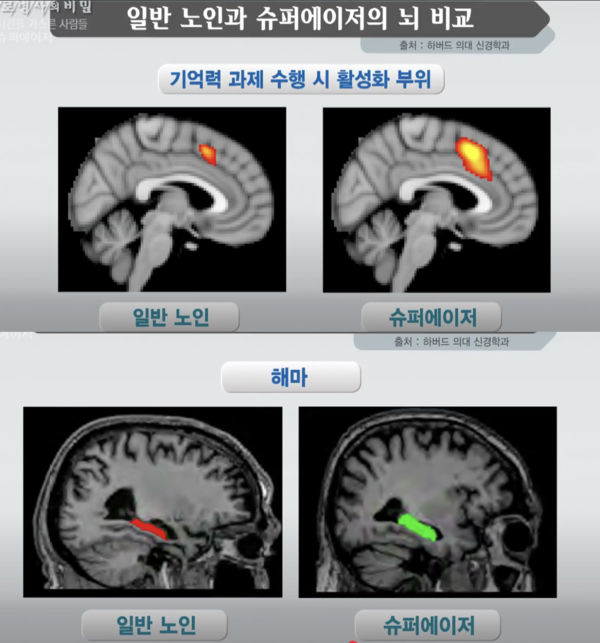 생로병사의 비밀 캡처