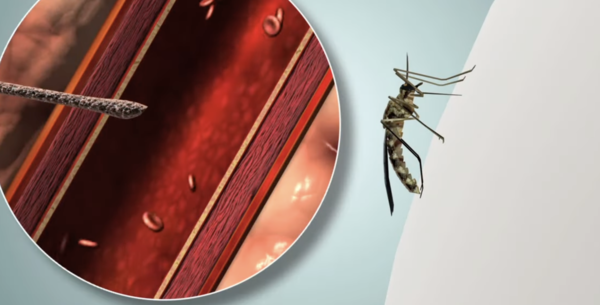 KBS 생로병사의 비밀 캡처