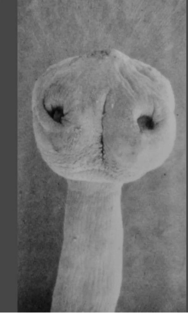 아시아조충(Taenia asiatica), Idk 화면 캡처